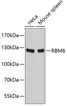 Western blot - RBM6 Monoclonal Antibody 