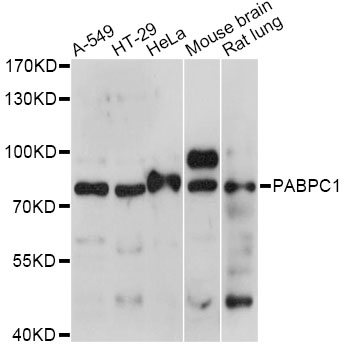 Western blot - PABPC1 Polyclonal Antibody 