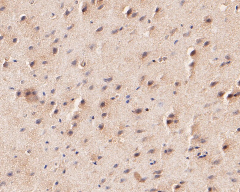 Fig5:; Immunohistochemical analysis of paraffin-embedded mouse brain tissue using anti-KCNK2 antibody. The section was pre-treated using heat mediated antigen retrieval with Tris-EDTA buffer (pH 8.0-8.4) for 20 minutes.The tissues were blocked in 5% BSA for 30 minutes at room temperature, washed with ddH; 2; O and PBS, and then probed with the primary antibody ( 1/100) for 30 minutes at room temperature. The detection was performed using an HRP conjugated compact polymer system. DAB was used as the chromogen. Tissues were counterstained with hematoxylin and mounted with DPX.