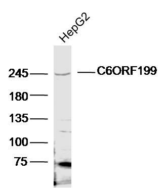 Fig2: Sample:HepG2 (Human)CellLysate t 40 ug; Primary: Anti-C6ORF199 at 1/300 dilution; Secondary: IRDye800CW Goat Anti-RabbitIgG at 1/20000 dilution; Predicted band size: 221kD; Observed band size: 245kD