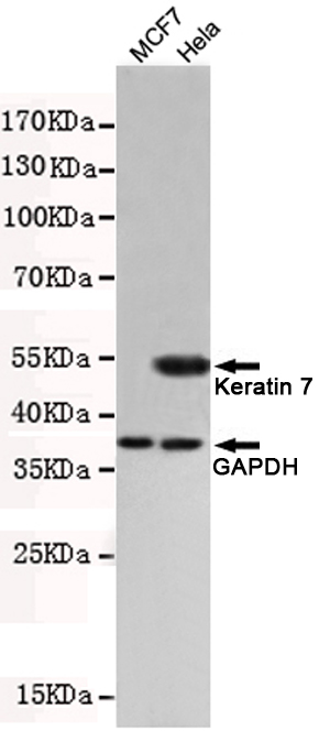 Western blot detection of Keratin 7(C-terminus) in Hela cell lysates which is positive expression and MCF7 cell lysates which is negative expression using Keratin 7(C-terminus) mouse mAb (1:500 diluted).Predicted band size: 55KDa,Observed band size: 55KDa.