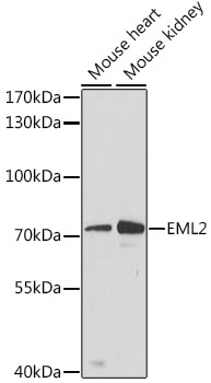 Western blot - EML2 Polyclonal Antibody 
