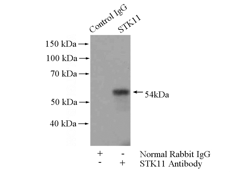 IP Result of anti-STK11 (IP:Catalog No:112249, 4ug; Detection:Catalog No:112249 1:500) with HEK-293 cells lysate 2000ug.