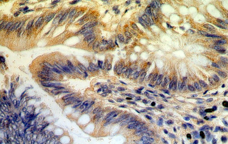 Immunohistochemical of paraffin-embedded human colon using Catalog No:117091(B3GNT3 antibody) at dilution of 1:100 (under 40x lens)