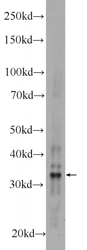 mouse liver tissue were subjected to SDS PAGE followed by western blot with Catalog No:108017(AMZ1 Antibody) at dilution of 1:1000
