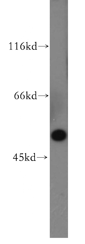 A549 cells were subjected to SDS PAGE followed by western blot with Catalog No:112705(MMP28 antibody) at dilution of 1:500