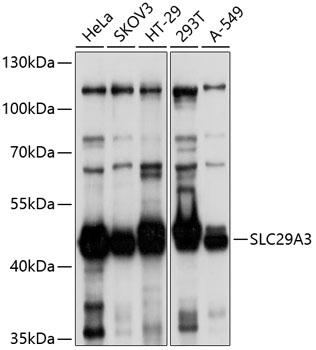 Western blot - SLC29A3 Polyclonal Antibody 