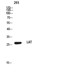 Western blot analysis of 293 using LAT antibody. Secondary antibody was diluted at 1:20000