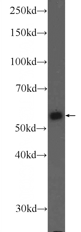 HeLa cells were subjected to SDS PAGE followed by western blot with Catalog No:113858(PKM Antibody) at dilution of 1:1000