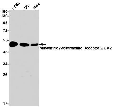 Western blot detection of Muscarinic Acetylcholine Receptor 2/CM2 in K562,C6,Hela cell lysates using Muscarinic Acetylcholine Receptor 2/CM2 Rabbit pAb(1:1000 diluted).Predicted band size:52kDa.Observed band size:52kDa.