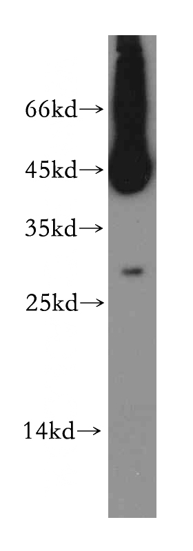 HepG2 cells were subjected to SDS PAGE followed by western blot with Catalog No:116443(TSPAN12 antibody) at dilution of 1:500