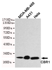 Western blot detection of CBR1 in Hela,A431 and MDA-MB-468 cell lysates using CBR1 mouse mAb (1:1000 diluted).Predicted band size:30KDa,Observed band size:30KDa.