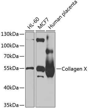 Western blot - Collagen X Polyclonal Antibody 