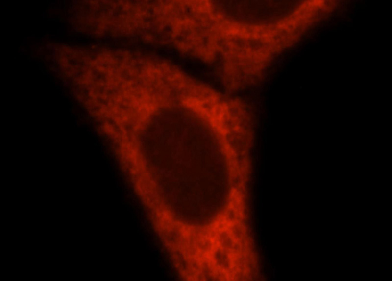 Immunofluorescent analysis of HepG2 cells, using WARS antibody Catalog No:116413 at 1:25 dilution and Rhodamine-labeled goat anti-rabbit IgG (red).