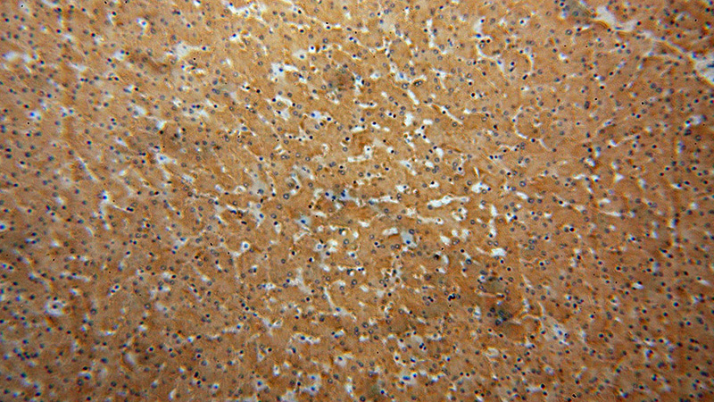 Immunohistochemical of paraffin-embedded human liver using Catalog No:113857(PKLR antibody) at dilution of 1:100 (under 10x lens)