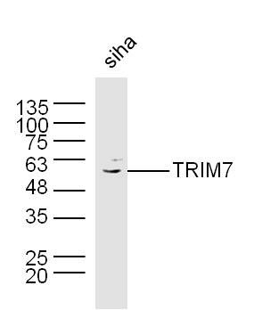 Fig1: Sample: Siha Cell (Human) Lysate at 40 ug; Primary: Anti-TRIM7 at 1/300 dilution; Secondary: IRDye800CW Goat Anti-Rabbit IgG at 1/20000 dilution; Predicted band size: 57 kD; Observed band size: 57 kD