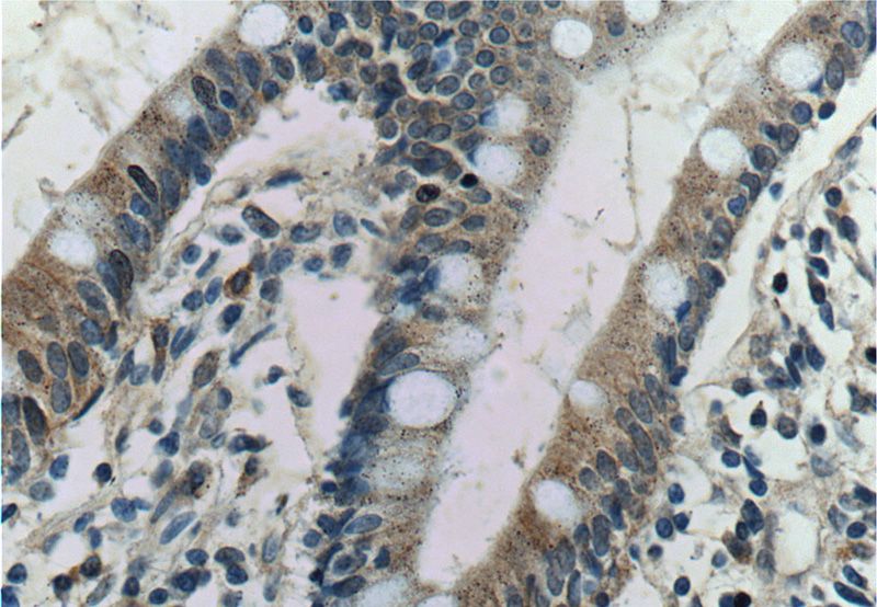 Immunohistochemistry of paraffin-embedded human small intestine tissue slide using Catalog No:112068(KCNJ13 Antibody) at dilution of 1:50 (under 40x lens)