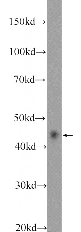 mouse spleen tissue were subjected to SDS PAGE followed by western blot with Catalog No:112667(MKNK2 Antibody) at dilution of 1:300