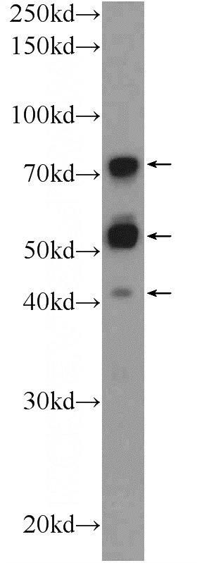 mouse testis tissue were subjected to SDS PAGE followed by western blot with Catalog No:116438(TSNAXIP1 Antibody) at dilution of 1:600