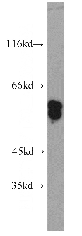 A431 cells were subjected to SDS PAGE followed by western blot with Catalog No:109807(KRT6A antibody) at dilution of 1:2000