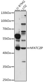 Western blot - NFATC2IP Polyclonal Antibody 