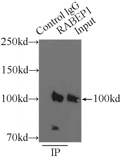 IP Result of anti-RABEP1 (IP:Catalog No:114493, 3ug; Detection:Catalog No:114493 1:500) with HeLa cells lysate 3800ug.