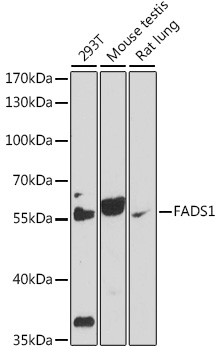 Western blot - FADS1 Polyclonal Antibody 