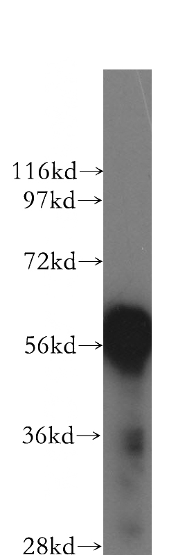 BxPC-3 cells were subjected to SDS PAGE followed by western blot with Catalog No:109291(CHST10 antibody) at dilution of 1:400