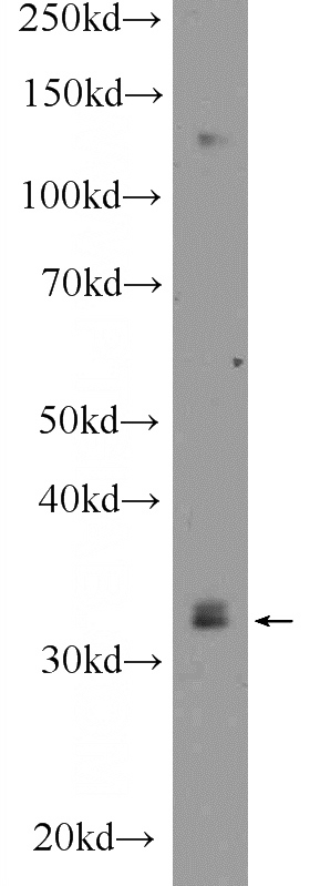 mouse testis tissue were subjected to SDS PAGE followed by western blot with Catalog No:111823(IQCK Antibody) at dilution of 1:600