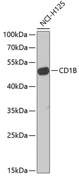 Western blot - CD1B Polyclonal Antibody 