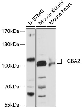 Western blot - GBA2 Polyclonal Antibody 