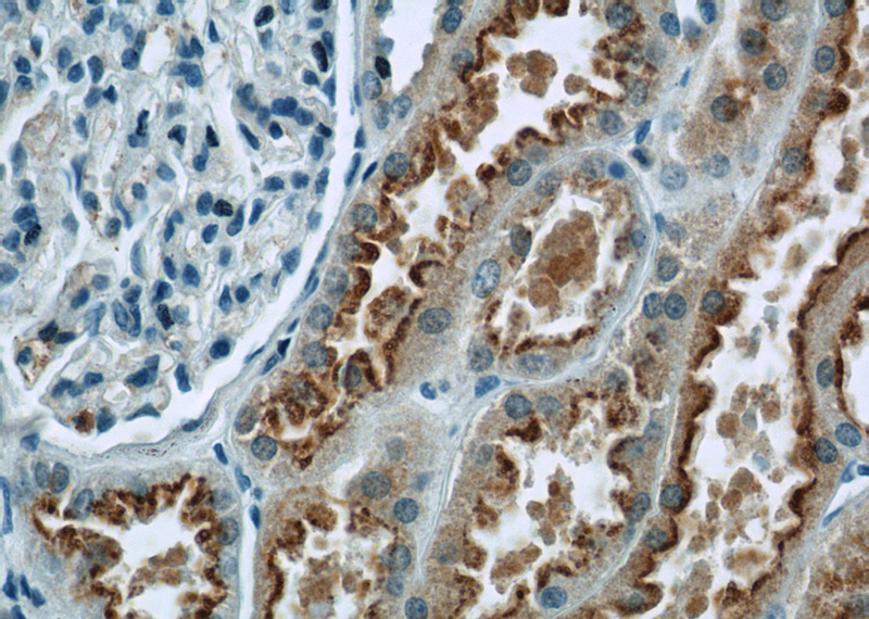 Immunohistochemistry of paraffin-embedded human kidney tissue slide using Catalog No:112671(TMEM67 Antibody) at dilution of 1:50 (under 40x lens)