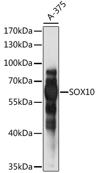 Western blot - SOX10 Polyclonal Antibody 