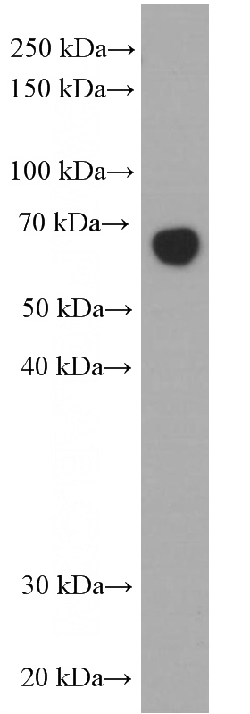 human plasma (diluted 5000 fold) was subjected to SDS PAGE followed by western blot with Catalog No:107569 (Albumin Antibody) at dilution of 1:10000