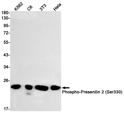 Western blot detection of Phospho-Presenilin 2 (Ser330) in K562,C6,3T3,Hela cell lysates using Phospho-Presenilin 2 (Ser330) Rabbit mAb(1:1000 diluted).Predicted band size:50kDa.Observed band size:23kDa.