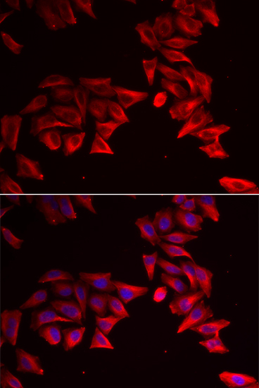 Immunofluorescence - SFRP4 Polyclonal Antibody 