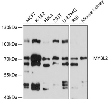 Western blot - MYBL2 Polyclonal Antibody 