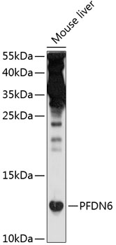 Western blot - PFDN6 Polyclonal Antibody 