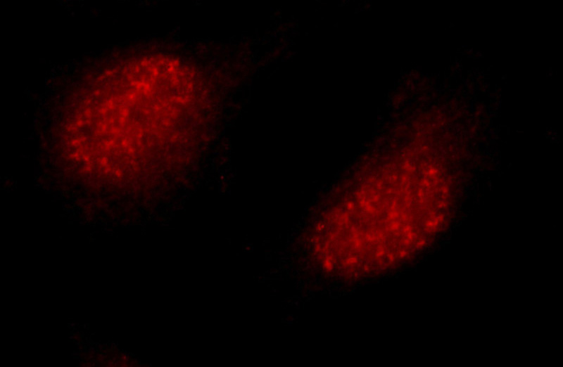 Immunofluorescent analysis of HepG2 cells using Catalog No:115758(SYCE1 Antibody) at dilution of 1:25 and Rhodamine-Goat anti-Rabbit IgG