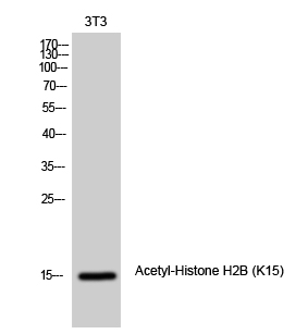 Fig1:; Western Blot analysis of 3T3 cells using Acetyl-Histone H2B (K15) Polyclonal Antibody diluted at 1: 1000. Secondary antibody（catalog#: HA1001) was diluted at 1:20000