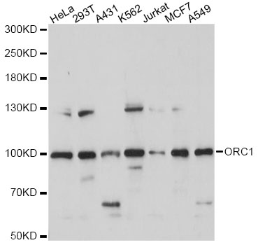Western blot - ORC1 Polyclonal Antibody 