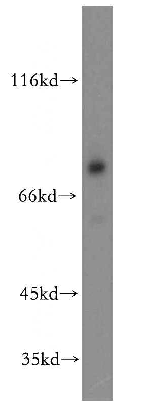 mouse brain tissue were subjected to SDS PAGE followed by western blot with Catalog No:109781(DDX17,P72 antibody) at dilution of 1:1000