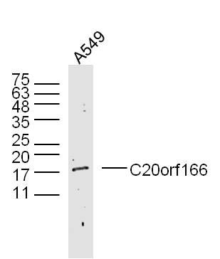 Fig1: Lane 1: (human/cell line)A549lysatesprobed withC20orf166Polyclonal Antibody, Unconjugated (Catalog #175251#) at 1:300 overnight at 4ⅹC. Followed by a conjugated secondary antibody (Secondary Catalog #926-32211) at 1:10000 for 60 min at 37ⅹC.