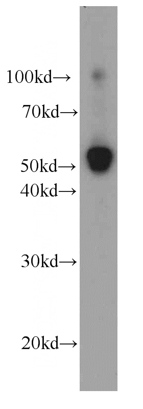 human placenta tissue were subjected to SDS PAGE followed by western blot with Catalog No:107274(IDS antibody) at dilution of 1:500