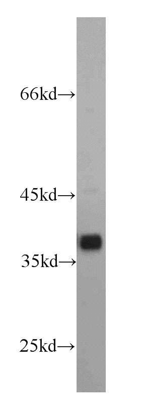 HEK-293 cells were subjected to SDS PAGE followed by western blot with Catalog No:115393(SMN2 antibody) at dilution of 1:1000