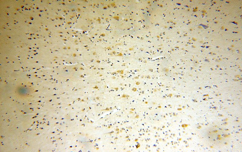 Immunohistochemical of paraffin-embedded human brain using Catalog No:108238(ARC antibody) at dilution of 1:100 (under 10x lens)
