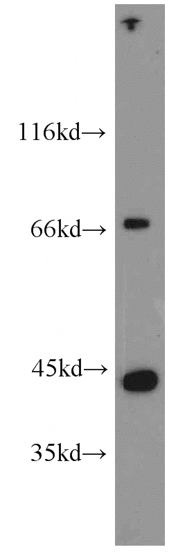 human heart tissue were subjected to SDS PAGE followed by western blot with Catalog No:111947(ITGB1BP2 antibody) at dilution of 1:600