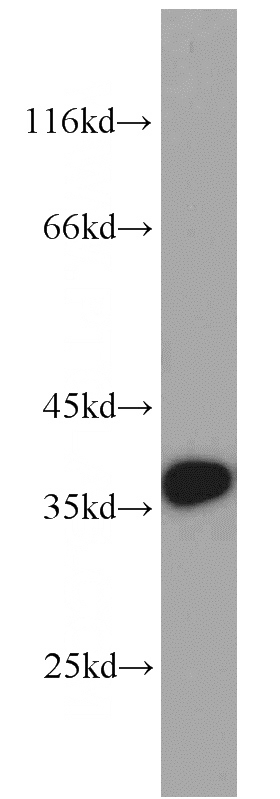A549 cells were subjected to SDS PAGE followed by western blot with Catalog No:112892(MUC8 antibody) at dilution of 1:500