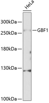 Western blot - GBF1 Polyclonal Antibody 