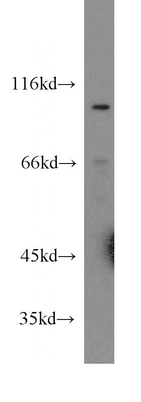 COLO 320 cells were subjected to SDS PAGE followed by western blot with Catalog No:108775(CDH18 antibody) at dilution of 1:300